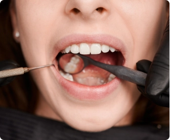 Emergency Dentistry
If you are experiencing a dental emergency, call and book at Harrington Park and Oran Park Dental Care now. We’ll fit you in on the same day if possible.
Click Here