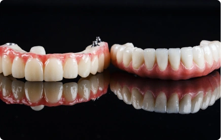 Same Day Full Arch Placement
In some cases, extractions and implant placement can happen in the same appointment, with a temporary bridge fitted the same day. Whether that's suitable comes down to the condition of your remaining teeth and the surrounding bone, which we'll assess when we see you.