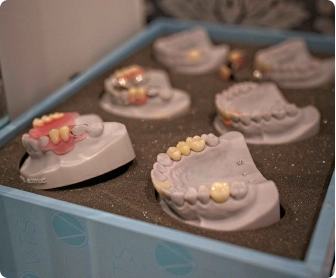 Dentures
We provide custom-made dentures designed to fit comfortably and restore the appearance and function of your smile. Our team at Harrington Park Dental Care and Oran Park Dental Care will discuss the options suitable for you.
Click Here