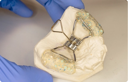 Expanders
An orthodontic expander may be recommended for some children with a narrow upper jaw. The appliance is designed to gradually widen the upper jaw while growth is still occurring and may help create additional space for developing teeth.